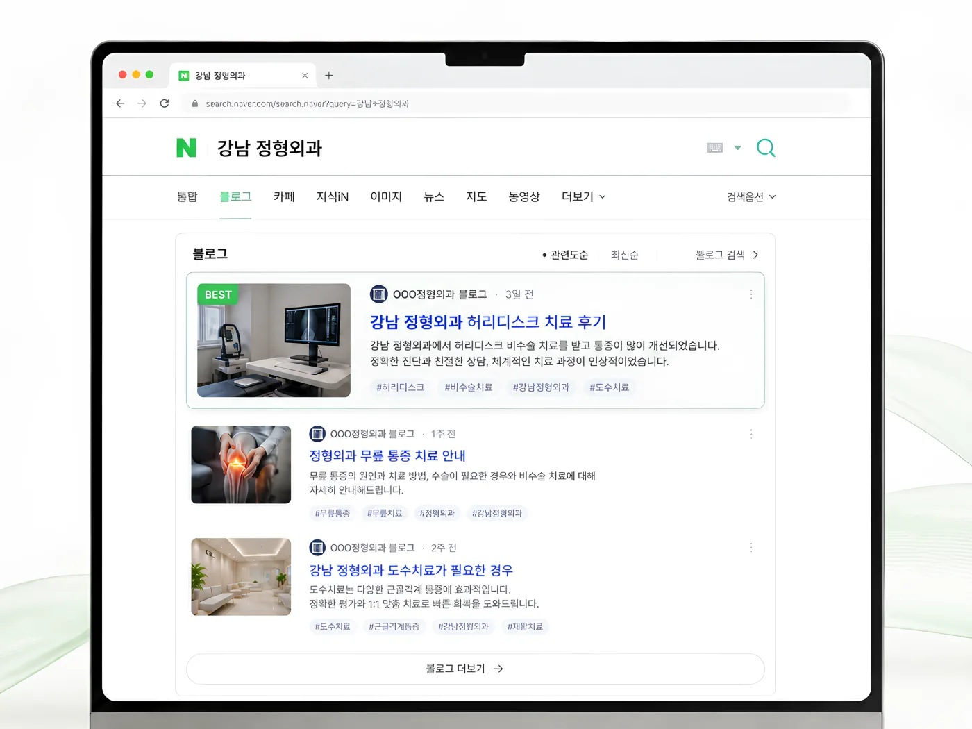 네이버 최적화 블로그